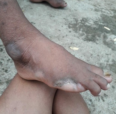 Condition After 2 Years