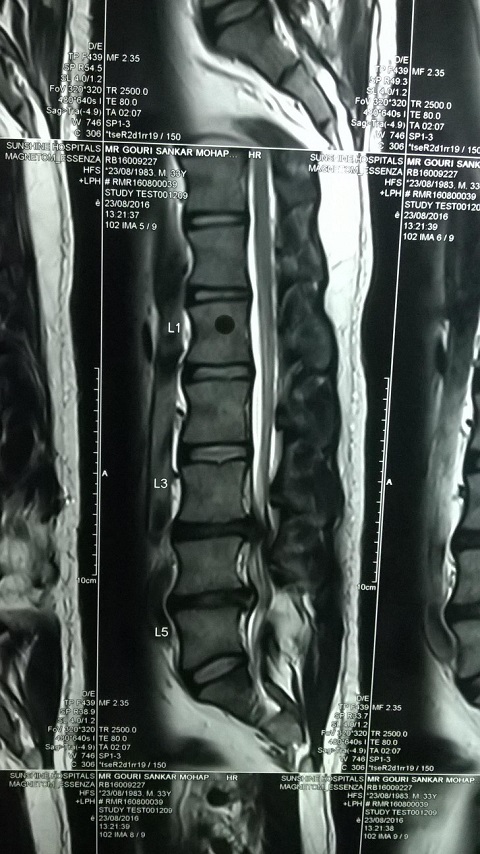 MRI - Gouri Shankar Mohapatra