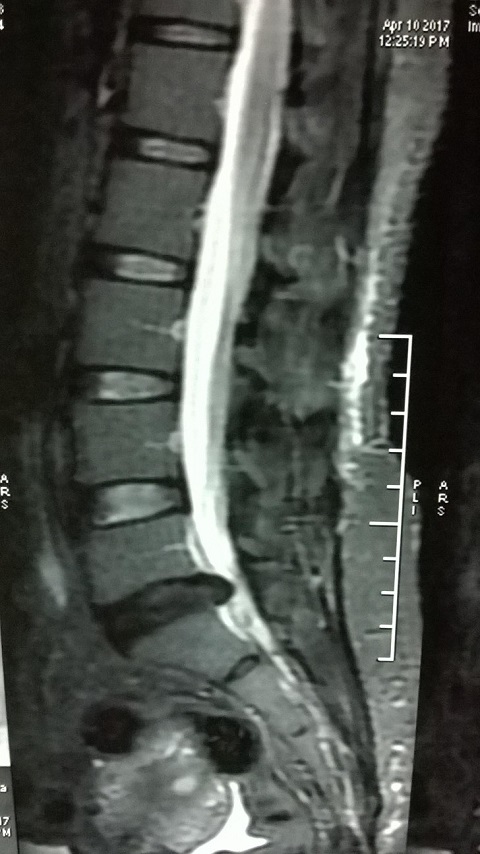 MRI - Geetanjali Behere
