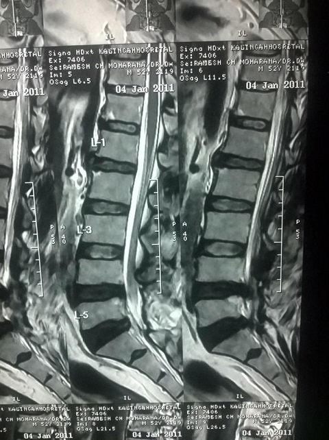 MRI - Geetanjali Behere